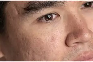 Cara bersihkan pori-pori wajah agar kembali rapat pakai 1 jenis ampas minuman, tak perlu beli skincare