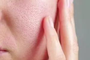 Cara bersihkan pori-pori wajah agar kulit terlihat mulus pakai 1 jenis tepung, wajah auto glowing 