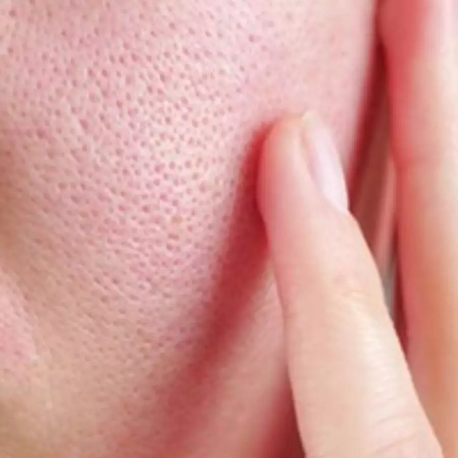 Cara bersihkan pori-pori wajah agar kulit terlihat mulus pakai 1 jenis tepung, wajah auto glowing 