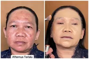 Natural meski pakai foundation tebal, transformasi wanita dengan flek hitam manglingi bak beda orang