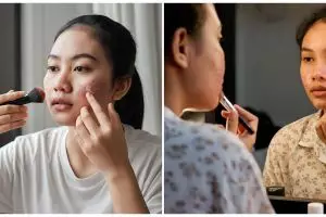 Makeup untuk kulit berjerawat, ini 5 produk aman yang nggak bikin breakout