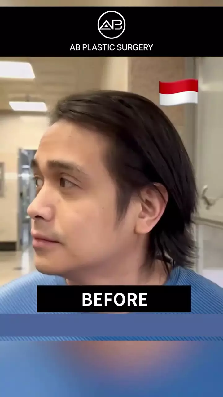 ajun perwira operasi plastik © 2025 TikTok ajun perwira operasi plastik © 2025 TikTok