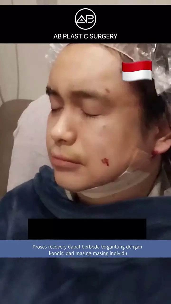 ajun perwira operasi plastik © 2025 TikTok ajun perwira operasi plastik © 2025 TikTok