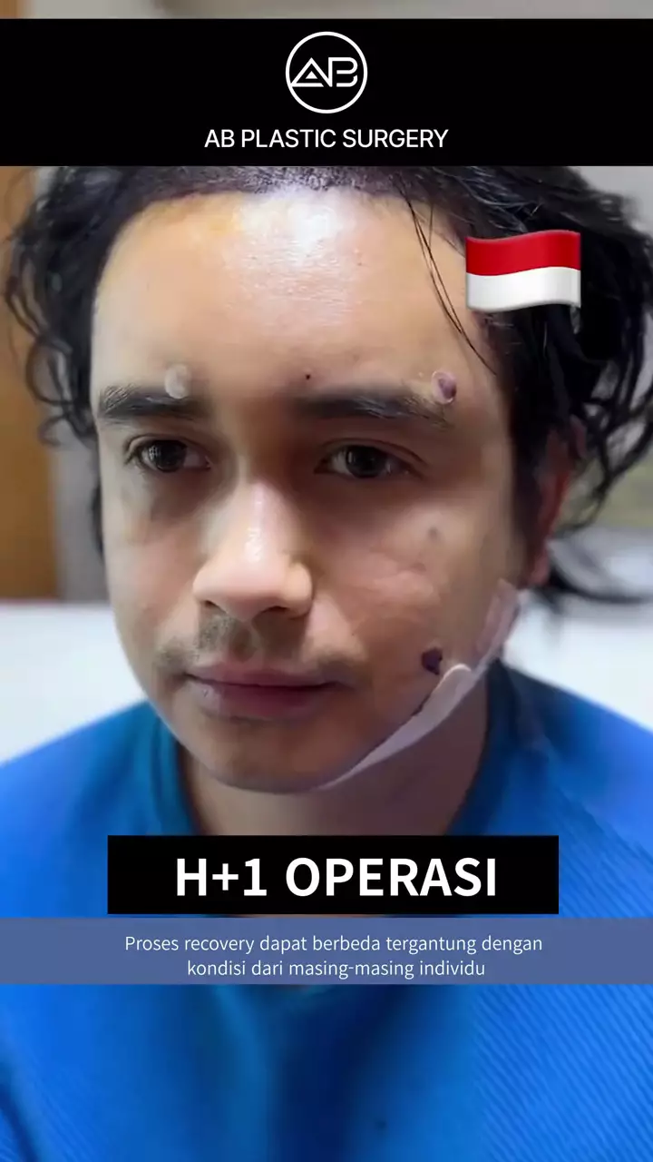 ajun perwira operasi plastik © 2025 TikTok ajun perwira operasi plastik © 2025 TikTok