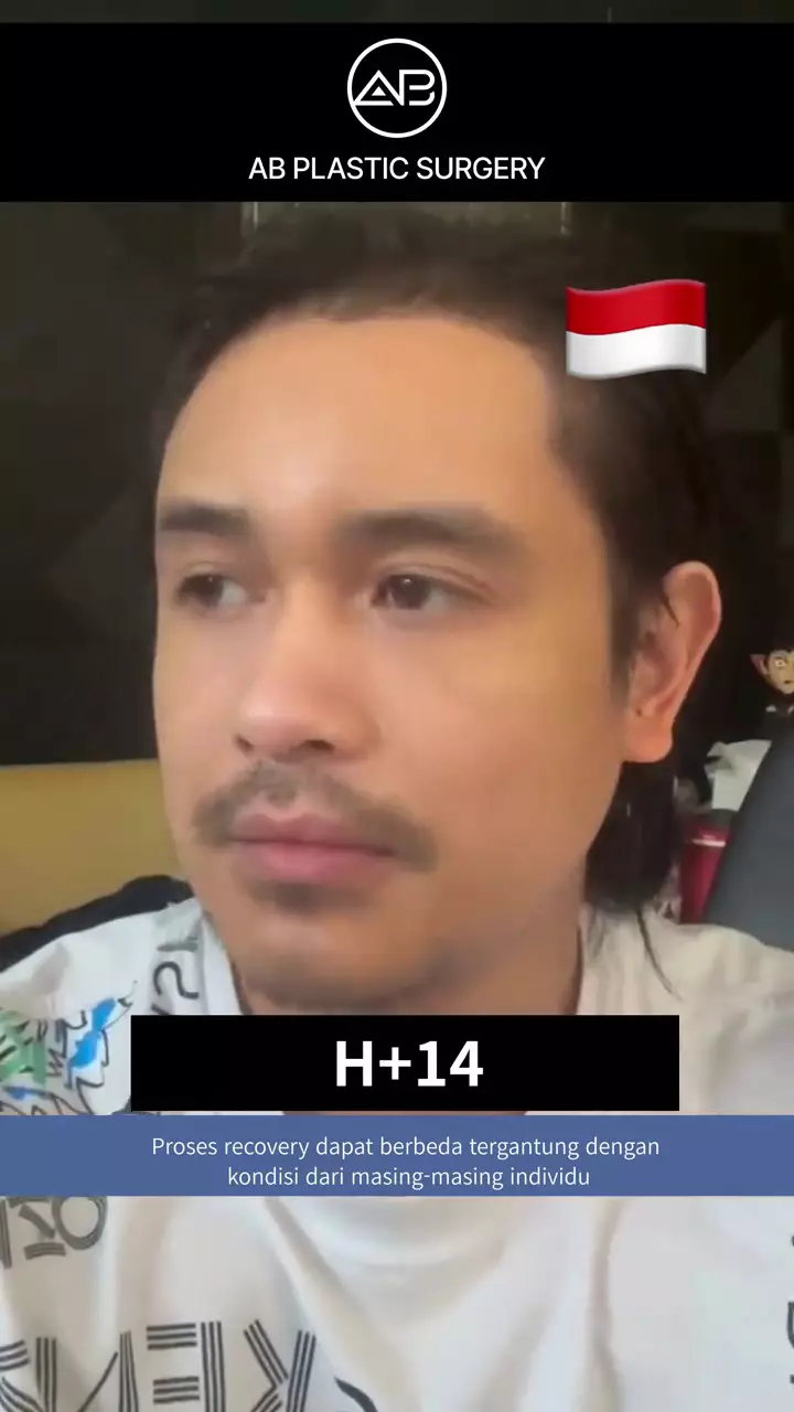 ajun perwira operasi plastik © 2025 TikTok ajun perwira operasi plastik © 2025 TikTok