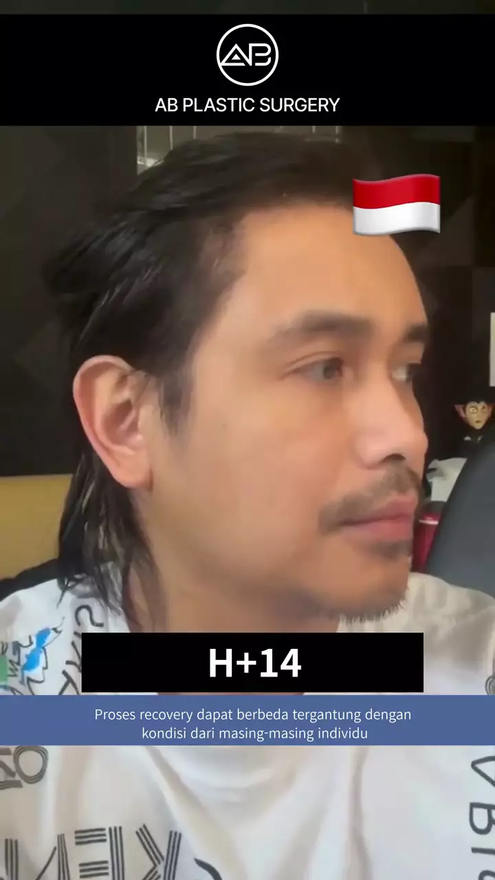 ajun perwira operasi plastik © 2025 TikTok ajun perwira operasi plastik © 2025 TikTok