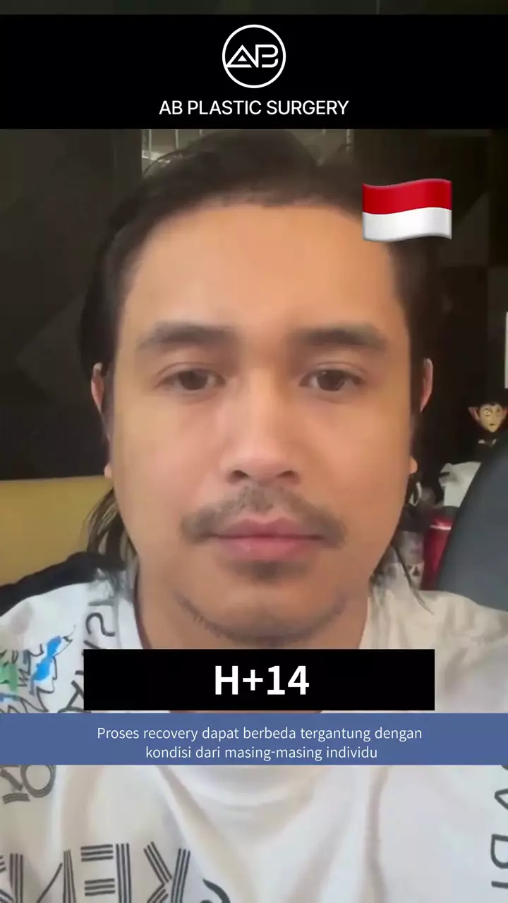 ajun perwira operasi plastik © 2025 TikTok ajun perwira operasi plastik © 2025 TikTok