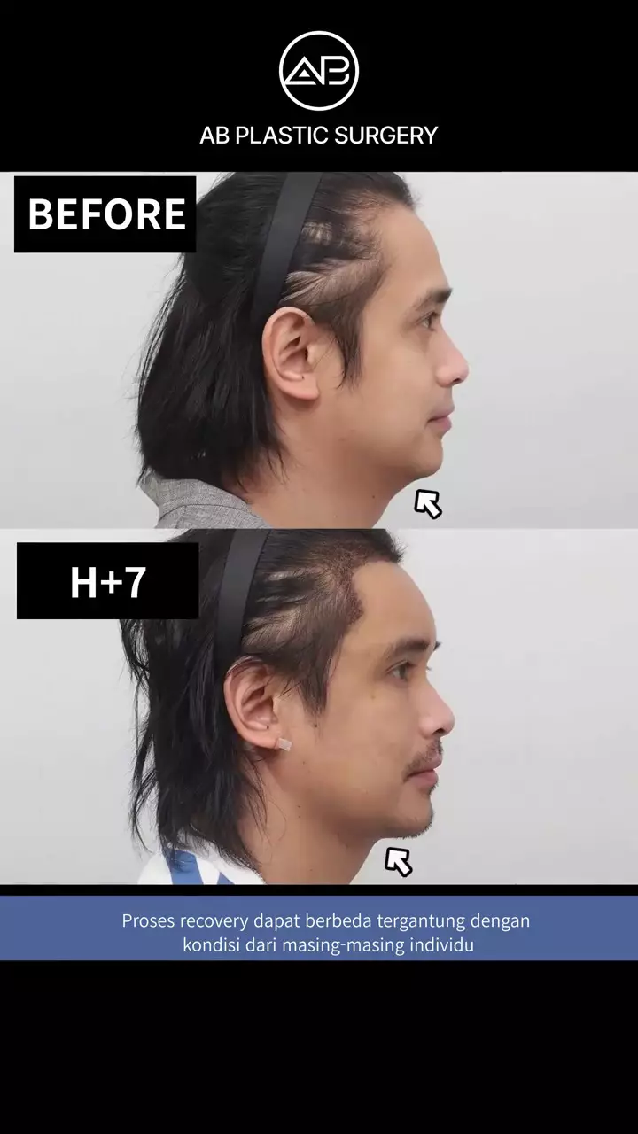 ajun perwira operasi plastik © 2025 TikTok ajun perwira operasi plastik © 2025 TikTok