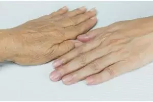 Cara atasi tangan kasar dan keriput dengan 1 jenis buah-buahan, auto mulus dan wangi sepanjang hari