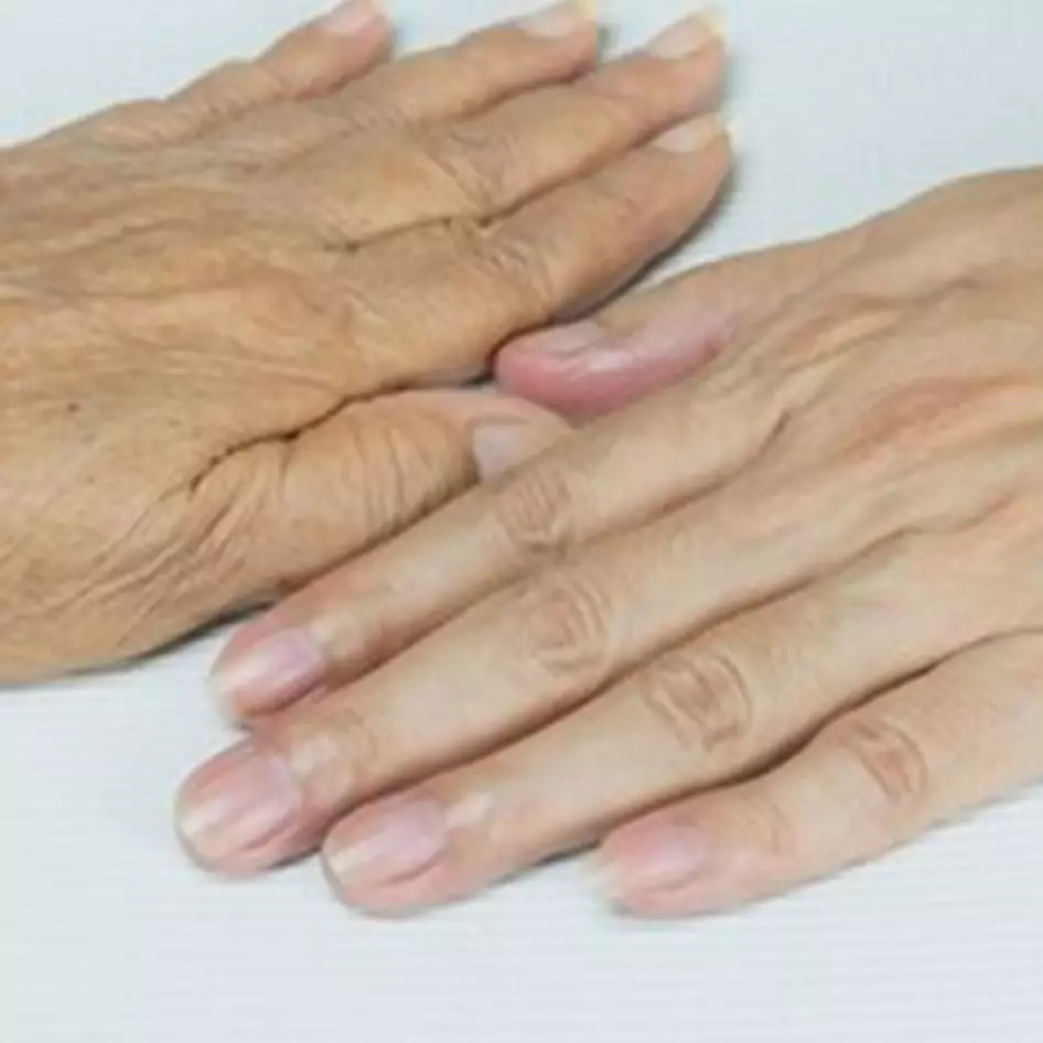 Cara atasi tangan kasar dan keriput dengan 1 jenis buah-buahan, auto mulus dan wangi sepanjang hari