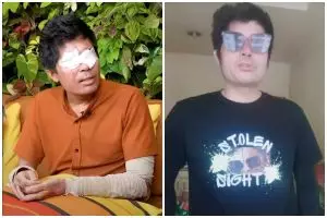 Ingat Agus Salim korban penyiraman air keras? Usai gagal dapat uang donasi begini profesinya sekarang