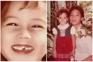 Bocah gigi ompong ini masih melajang di usia 45 tahun, ini 11 transformasinya kini jadi pesinetron