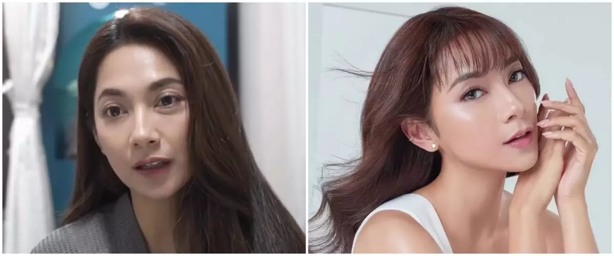 9 Transformasi Dinda Kirana jalani oplas wajah dan badan, hasilnya natural dan tampak lebih muda