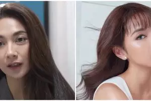 9 Transformasi Dinda Kirana jalani oplas wajah dan badan, hasilnya natural dan tampak lebih muda