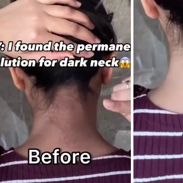 Cara eksfoliasi punggung leher gelap agar lebih cerah dan mulus dengan scrub dari 3 bahan dapur ini