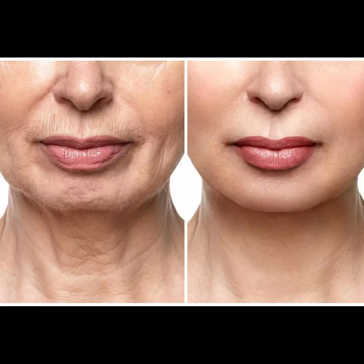 Wajah auto kencang lagi, ini cara ampuh pudarkan keriput cuma pakai masker dari 1 bahan minuman