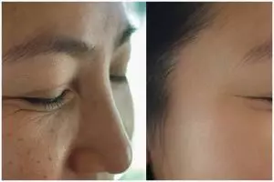 Hindari flek hitam akibat kosmetik bermerkuri, ini cara aman dan alami mengatasinya