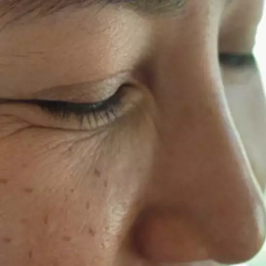 Hindari flek hitam akibat kosmetik bermerkuri, ini cara aman dan alami mengatasinya