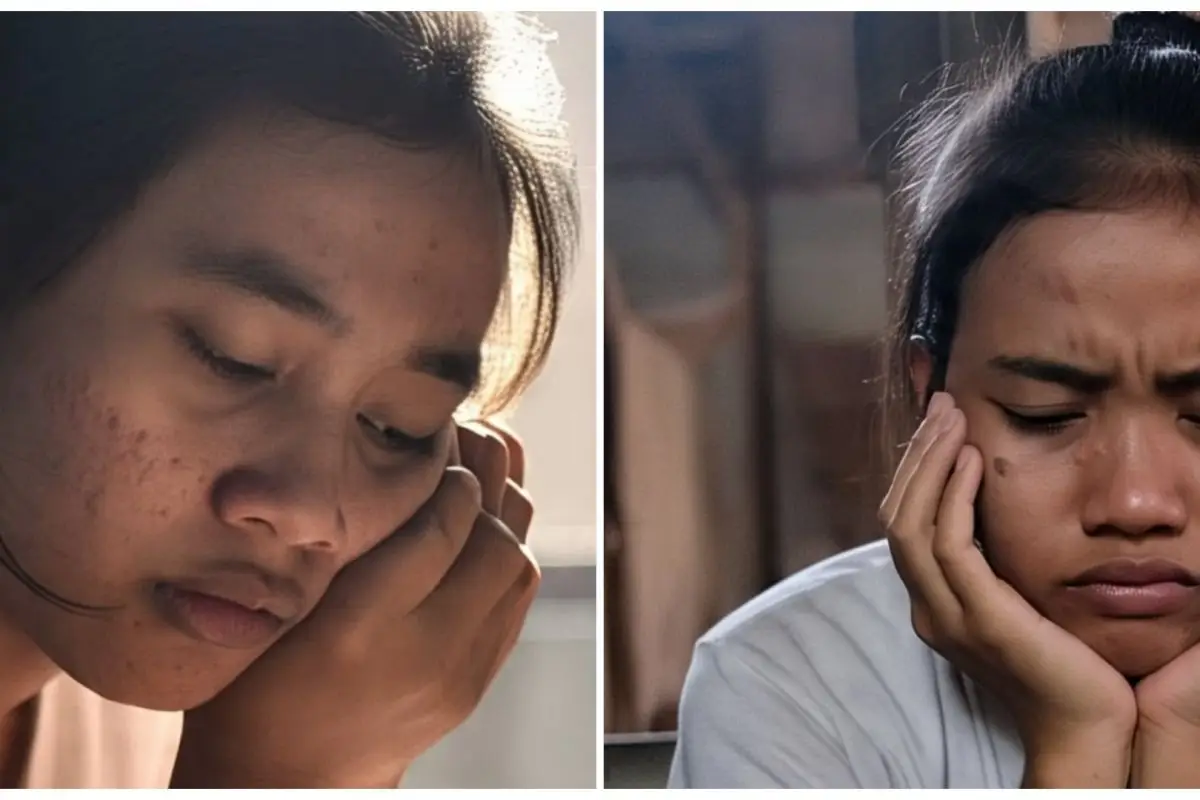 Salah urutan skincare bisa picu breakout parah, begini cara mengatasinya