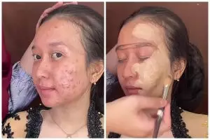 Transformasi makeup cewek breakout parah dirias tanpa foundation, nggak nyangka hasilnya bisa mulus