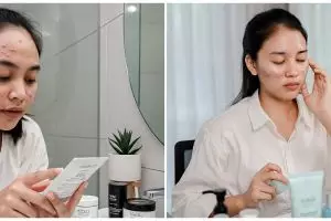 7 Kandungan skincare yang wajib kamu hindari kalau punya kulit sensitif