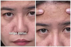 Bukan digosok pakai timun beku, begini cara kecilkan pori-pori besar cuma dengan 2 bahan dapur