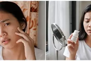 5 Ciri-ciri skincare tidak cocok di wajah, jangan tunggu parah