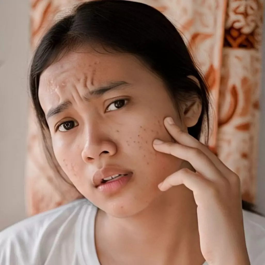 5 Ciri-ciri skincare tidak cocok di wajah, jangan tunggu parah