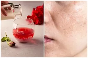 Tak cuma mencerahkan, begini cara pakai air mawar agar bantu kecilkan pori dan kontrol minyak wajah