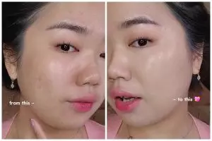 Jangan asal blend, ini cara ampuh samarkan bekas jerawat dengan concealer agar tertutup maksimal
