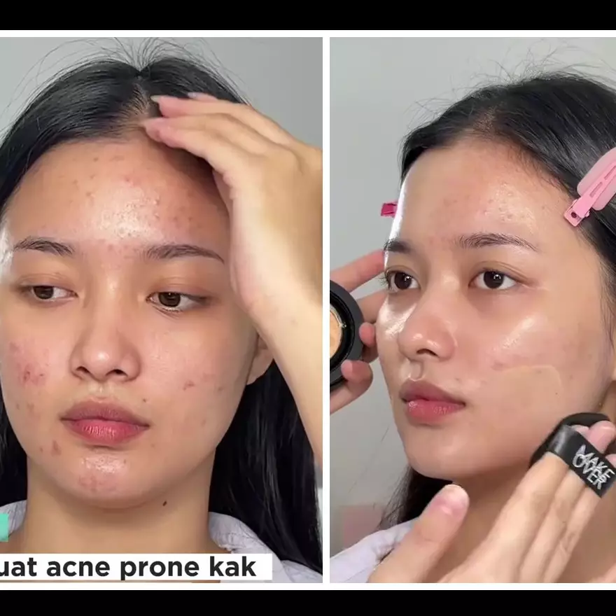 Padahal cuma pakai cushion, MUA ini sukses ubah wajah berjerawat jadi mulus alami bak hasil treatment