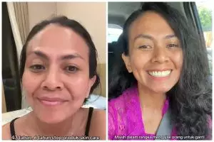 Kisah wanita 6 tahun lepas skincare dan 3 tahun tak pakai sunscreen, 7 potret hasilnya bikin takjub