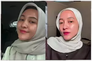 Tak perlu pakai serum mahal, cara kecilkan pori-pori ini ampuh bikin kulit mulus dalam 7 hari