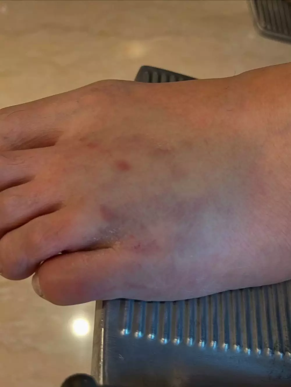 kaki fairuz a rafiq terinjak sapi kurban  © 2025 Instagram