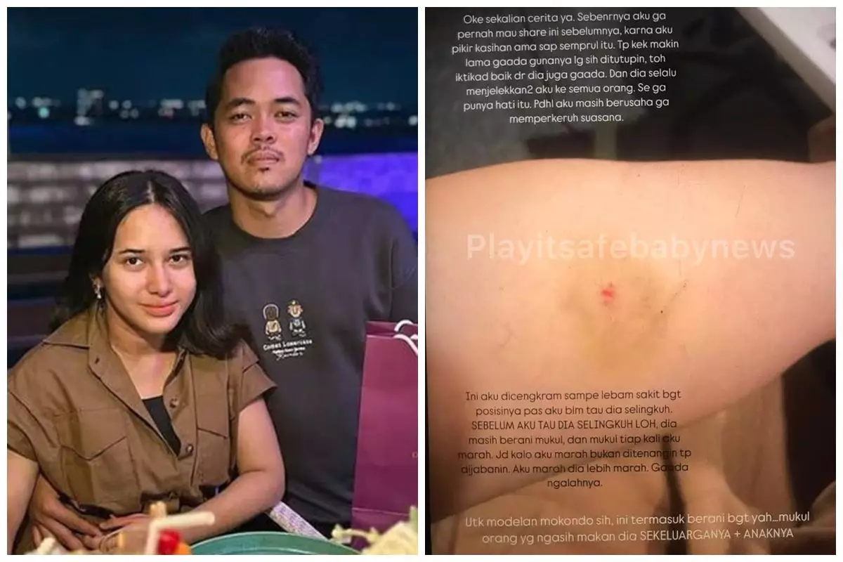 Sebelumnya ditutup-tutupi, Dilan Janiyar kini berani ungkap pernah alami KDRT dari Safnoviar