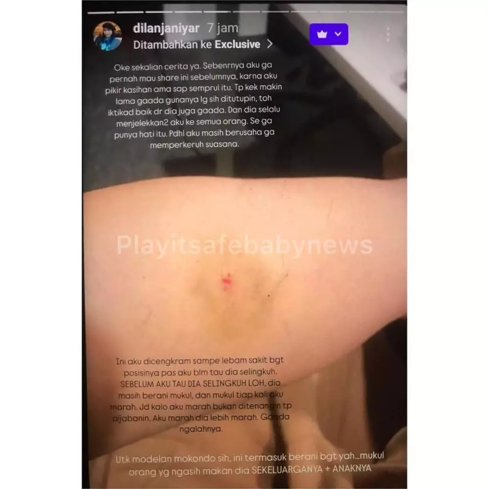 dilan janiyar pernah alami kdrt  © 2025 Instagram