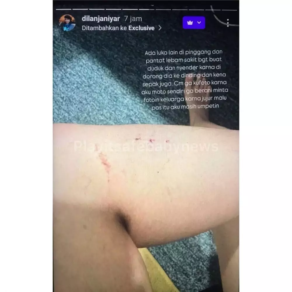 dilan janiyar pernah alami kdrt  © 2025 Instagram