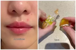 Wajah kencang bebas garis halus, wanita ini bagikan cara bikin jelly botox viral pakai 1 bahan minuman