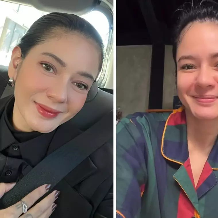 Modal Rp0, rutinitas skincare pagi ala Citra Anindya pacar Chef Juna ini bikin mulus bebas jerawat