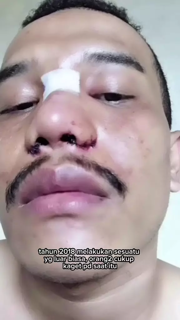 Pria rela oplas karena gagal dapat pekerjaan © 2025 TikTok