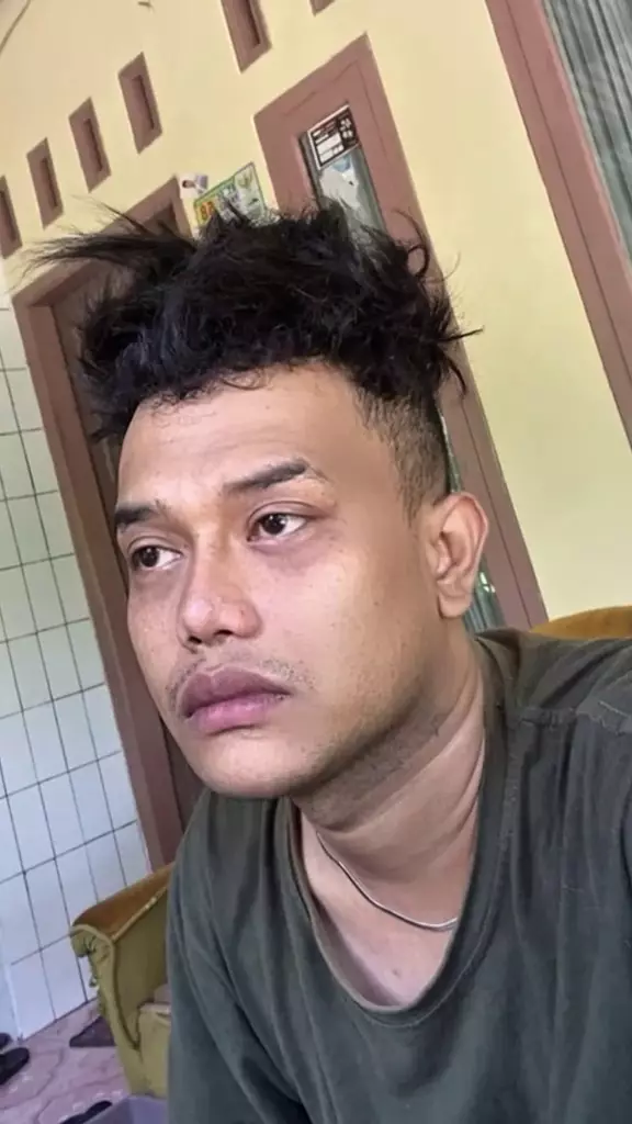 Pria rela oplas karena gagal dapat pekerjaan © 2025 TikTok