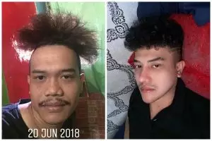 Muak gagal dapat pekerjaan karena dinilai fisiknya, pria ini oplas, 7 perubahannya bak beda orang