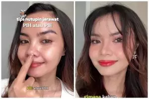 Bukan pakai color corrector oranye, ini trik tutup bekas jerawat sebelum makeup agar makin tersamarkan