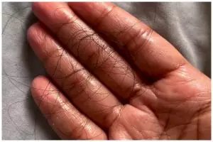 Tak perlu perawatan mahal, ini cara cegah rambut rontok dan uban cuma pakai 1 jenis bunga