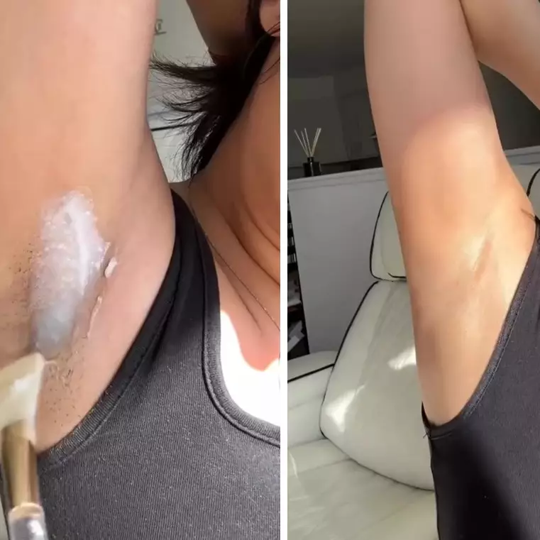 Tak perlu eksfoliasi, ketiak gelap bisa cerah dan halus seketika dengan 3 bahan dapur ini