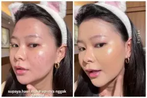 Concealer malah bikin bekas jerawat makin terlihat? Ini cara mengatasinya tanpa perlu tambahan produk