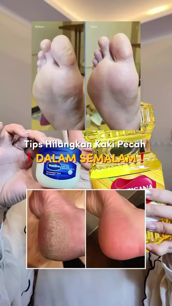 Kaki kering dan pecah-pecah langsung hilang © Instagram