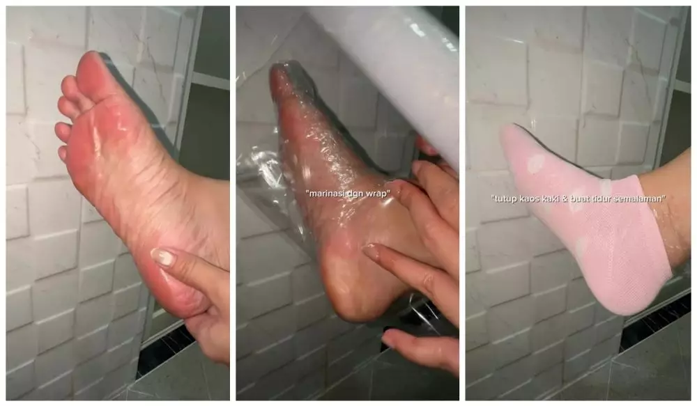 Kaki kering dan pecah-pecah langsung hilang © Instagram