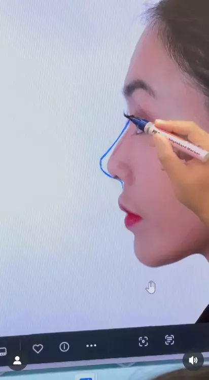 Denada setelah tiga kali operasi plastik © Instagram Denada setelah tiga kali operasi plastik © Instagram