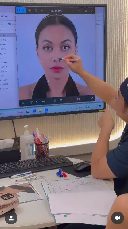 Denada setelah tiga kali operasi plastik © Instagram Denada setelah tiga kali operasi plastik © Instagram